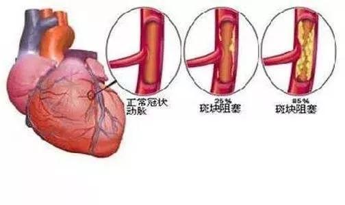 远光瑞康高电位 高电位厂家